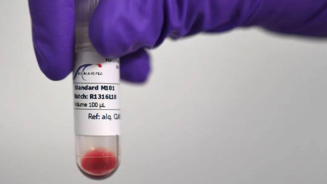 环法车手试图获取沙虫血红蛋白——一种血液兴奋剂插图